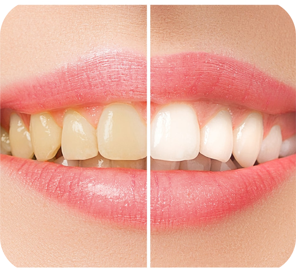 Cosmetic Dentistry