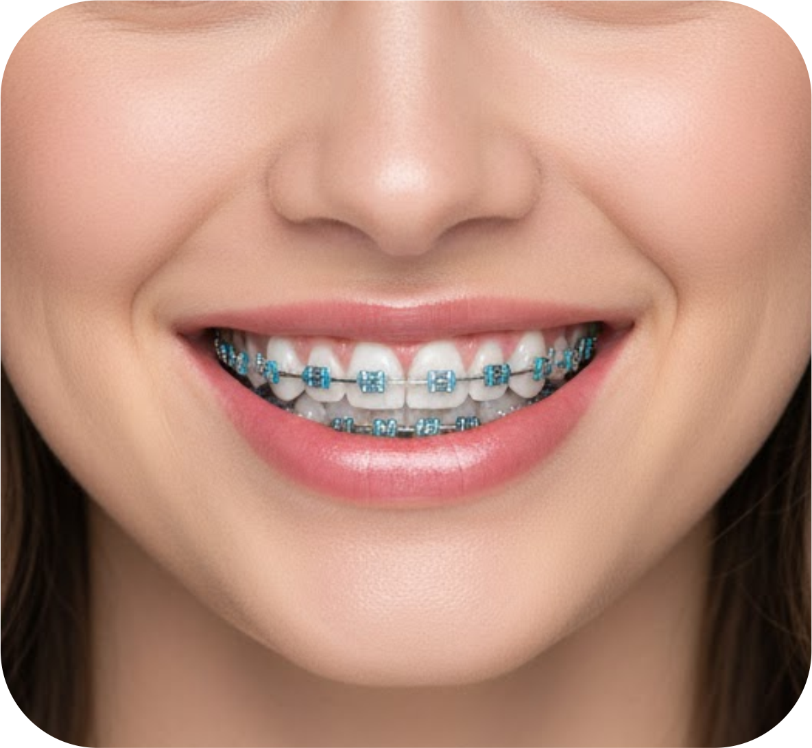 Orthodontics