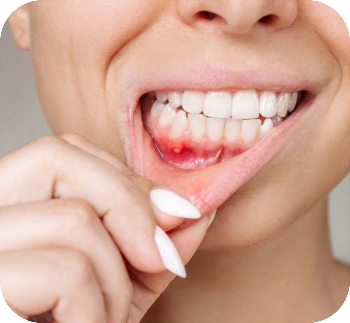 Periodontics