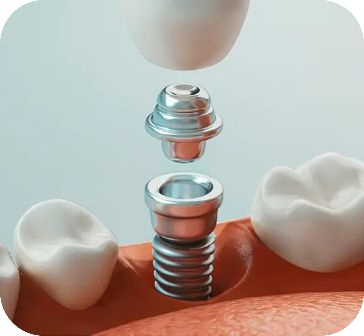 Prosthodontics
