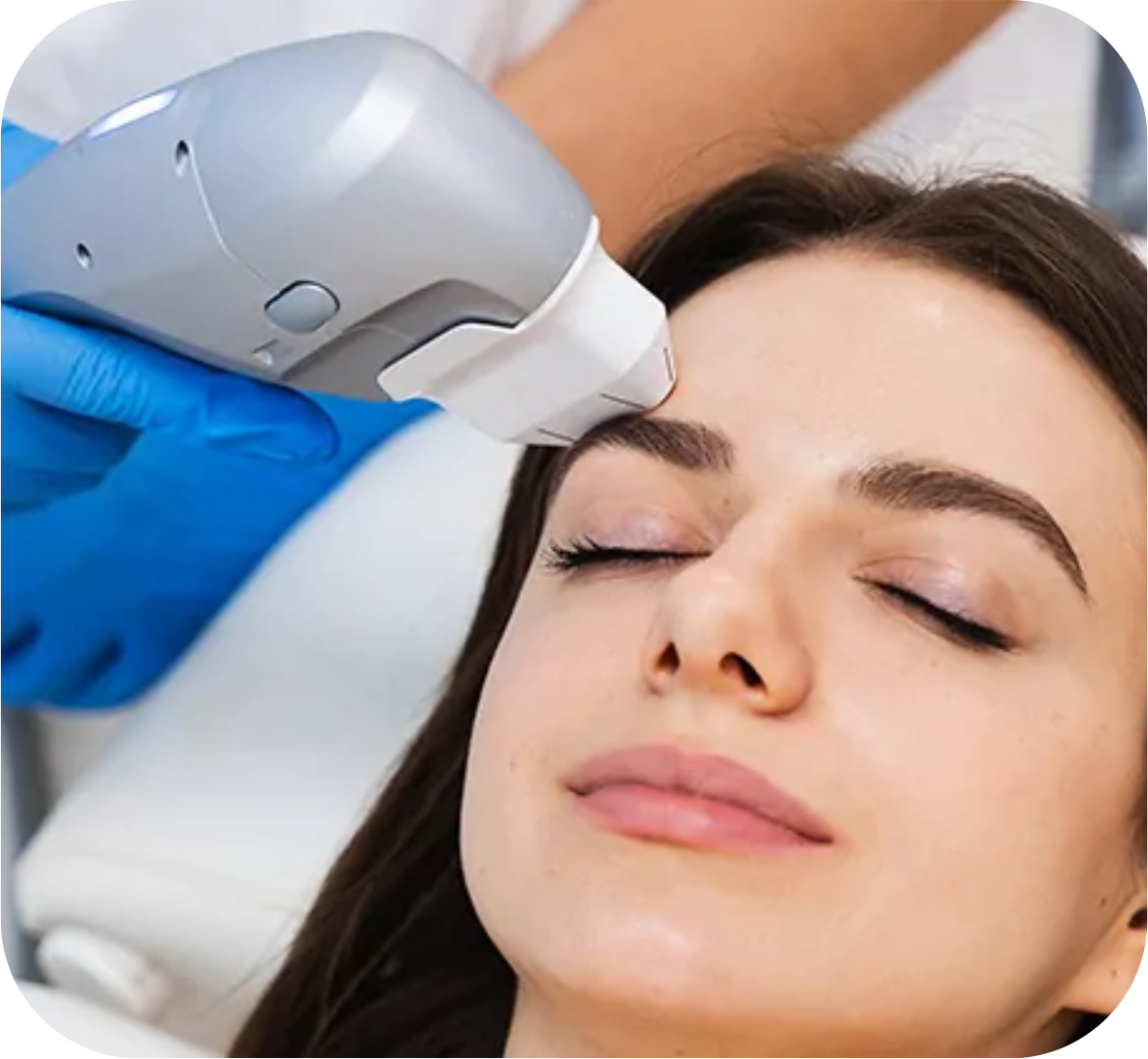 Laser Treatments